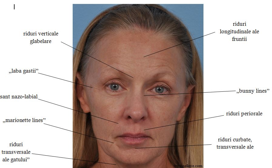 5 moduri de a masca ridurile de pe frunte
